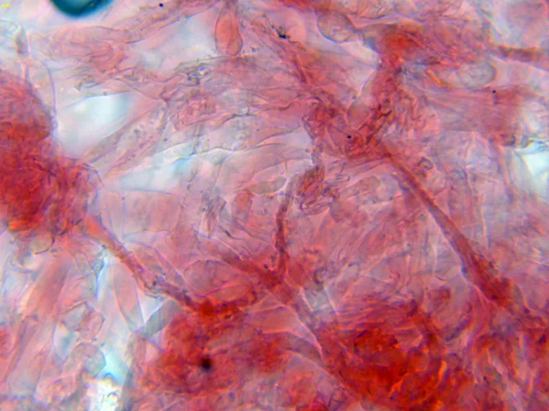 Asterophora lycoperdoides 10 - Hifas trama-004